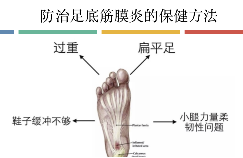 脚底酸痛的人必须看的 足底筋膜炎的保健方法 知乎