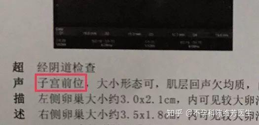 子宫前位、后位、水平位,到底啥意思?一次性帮你搞清楚! - 知乎