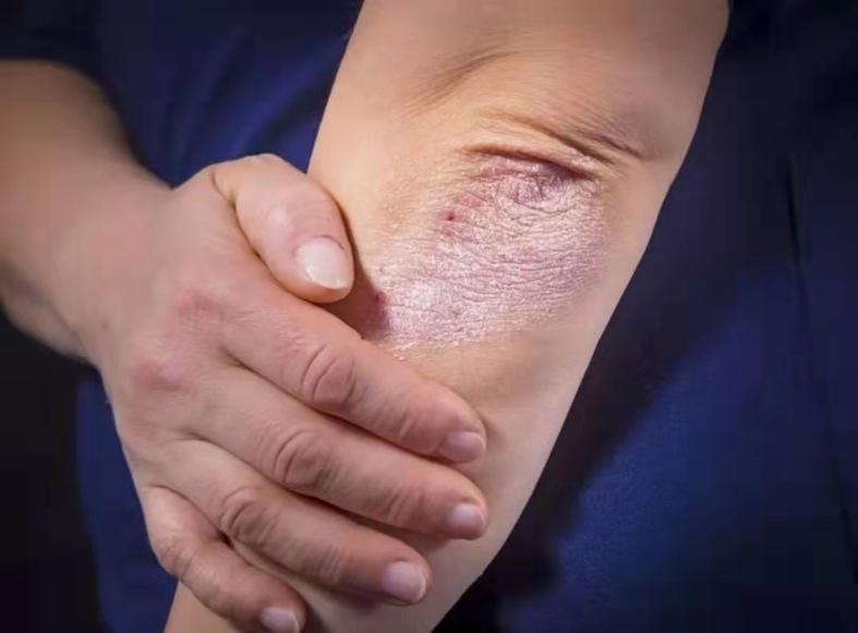 老年人皮肤容易干,瘙痒,怎么缓解? - 知乎