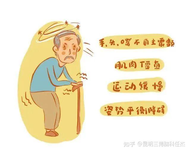 手脚僵硬、步态不稳易跌倒,帕金森病人走路越来越差怎么办? - 知乎