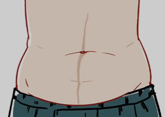 为什么女性肚子上会有条褐色的线啊?