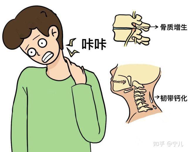 颈椎病图片高清卡通图片