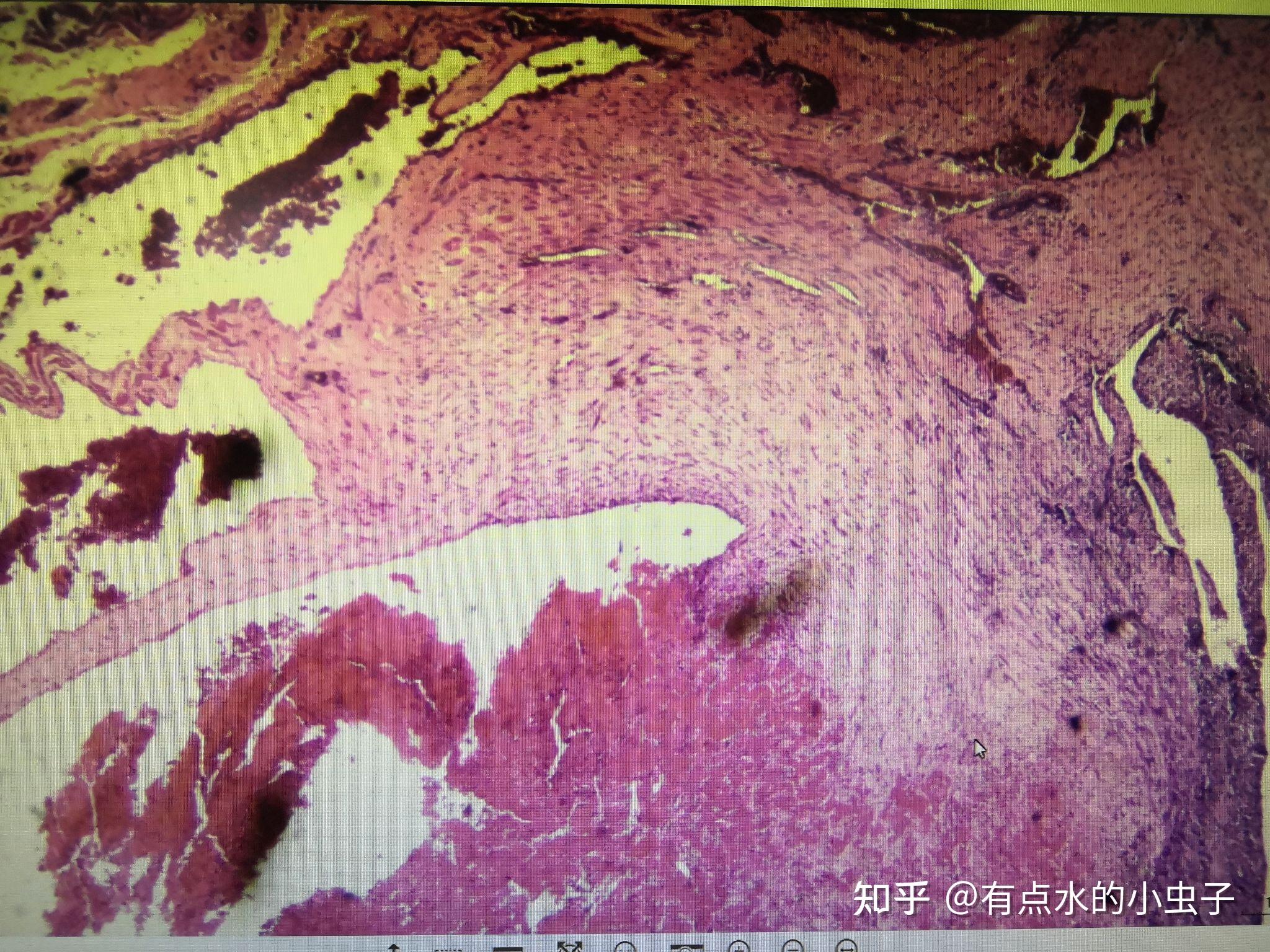 病理切片圖-鏡下 - 知乎