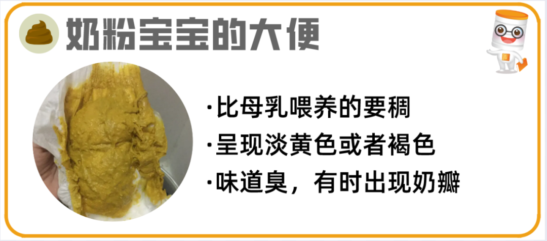 逾20种宝宝大便图片详解！最后10种必须警惕！ - 知乎