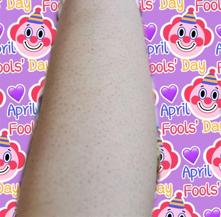 腿上有红点点像是毛孔堵塞一样怎么让汗毛长出来啊