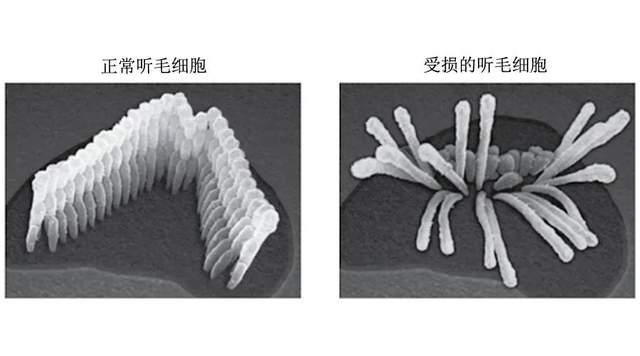 这个几乎100可预防的听力损失你知道吗