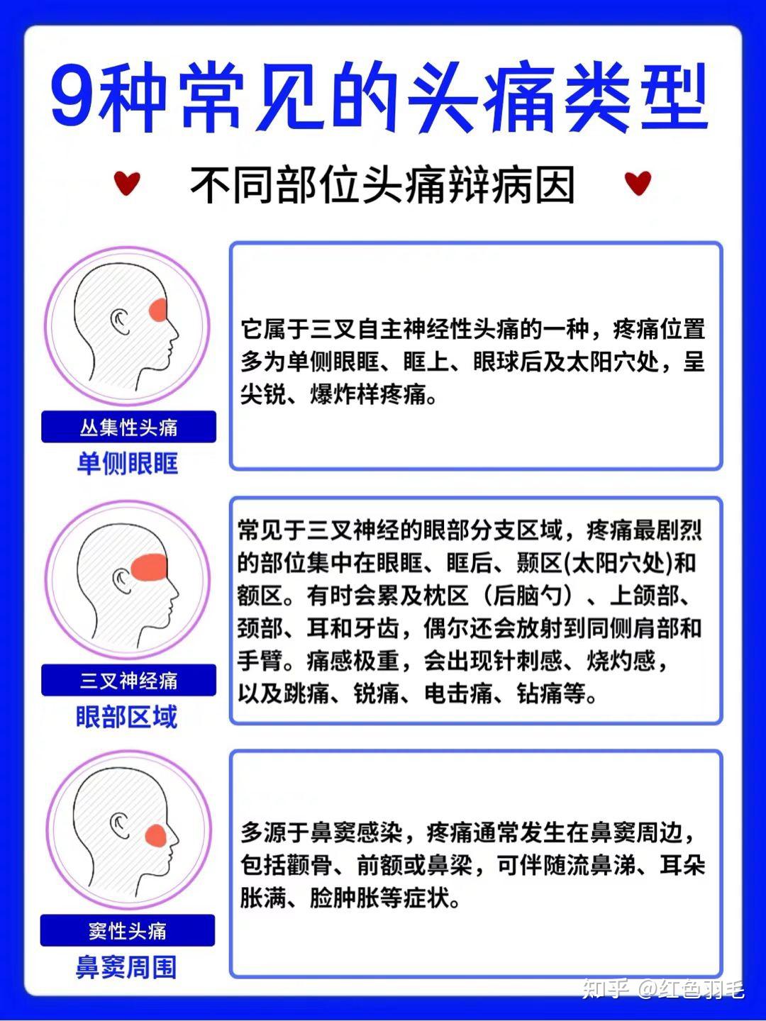 9種常見的頭疼類型 - 知乎