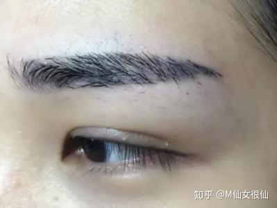 什么方法洗掉眉毛纹 v2-bafb4eb7fe736bee7a920684f2fe60c6_b.jpg