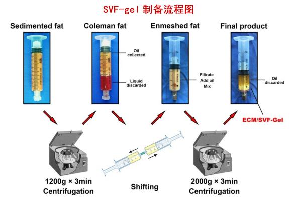 脂肪干细胞胶SVF-gel与面部年轻化 - 知乎