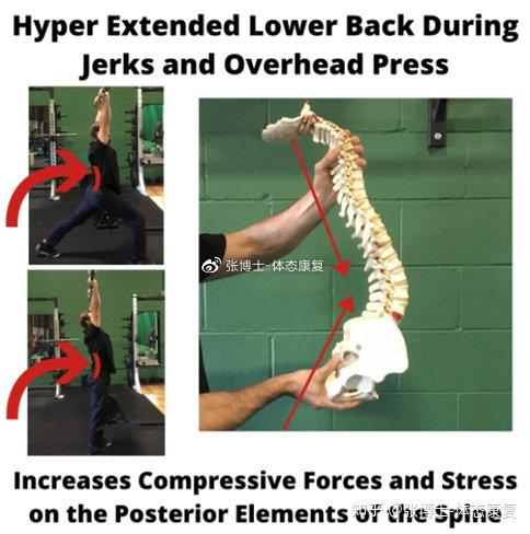 【译文分享】为什么训练中会出现腰椎过伸而导致下背痛