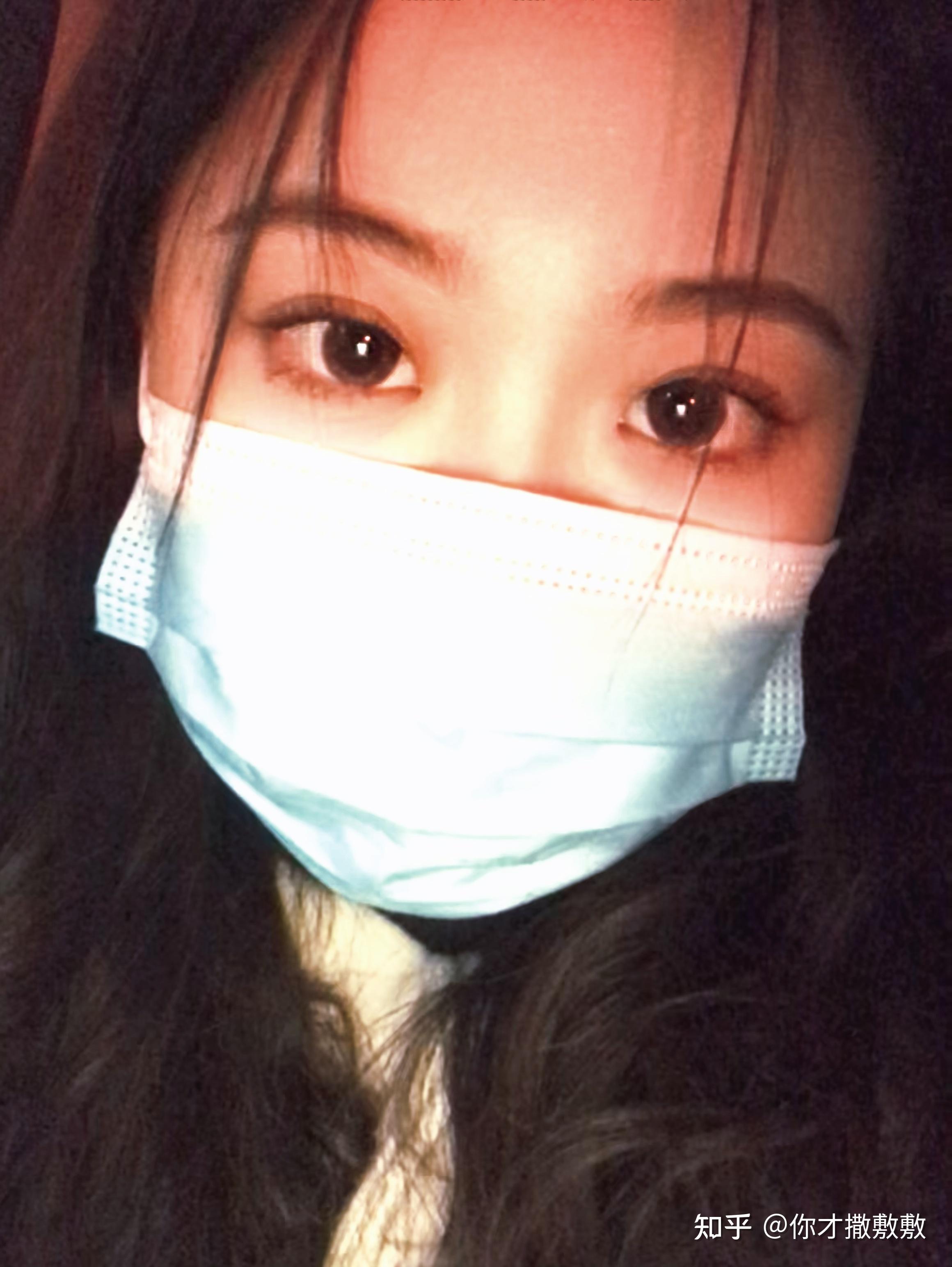 郝红梅日式无痕双眼皮