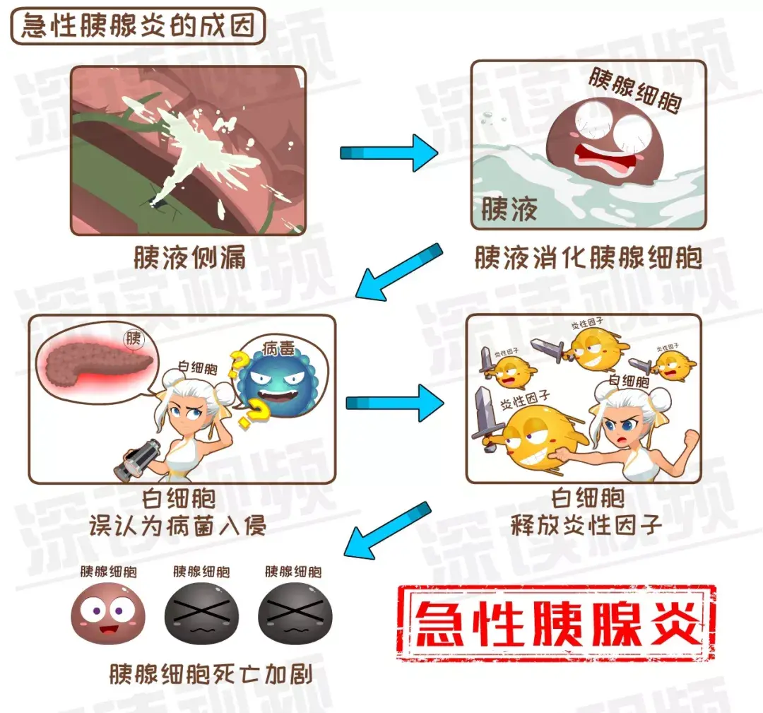胰腺为啥发炎致死腹痛背后真相是啥胰腺炎发病机制动漫版