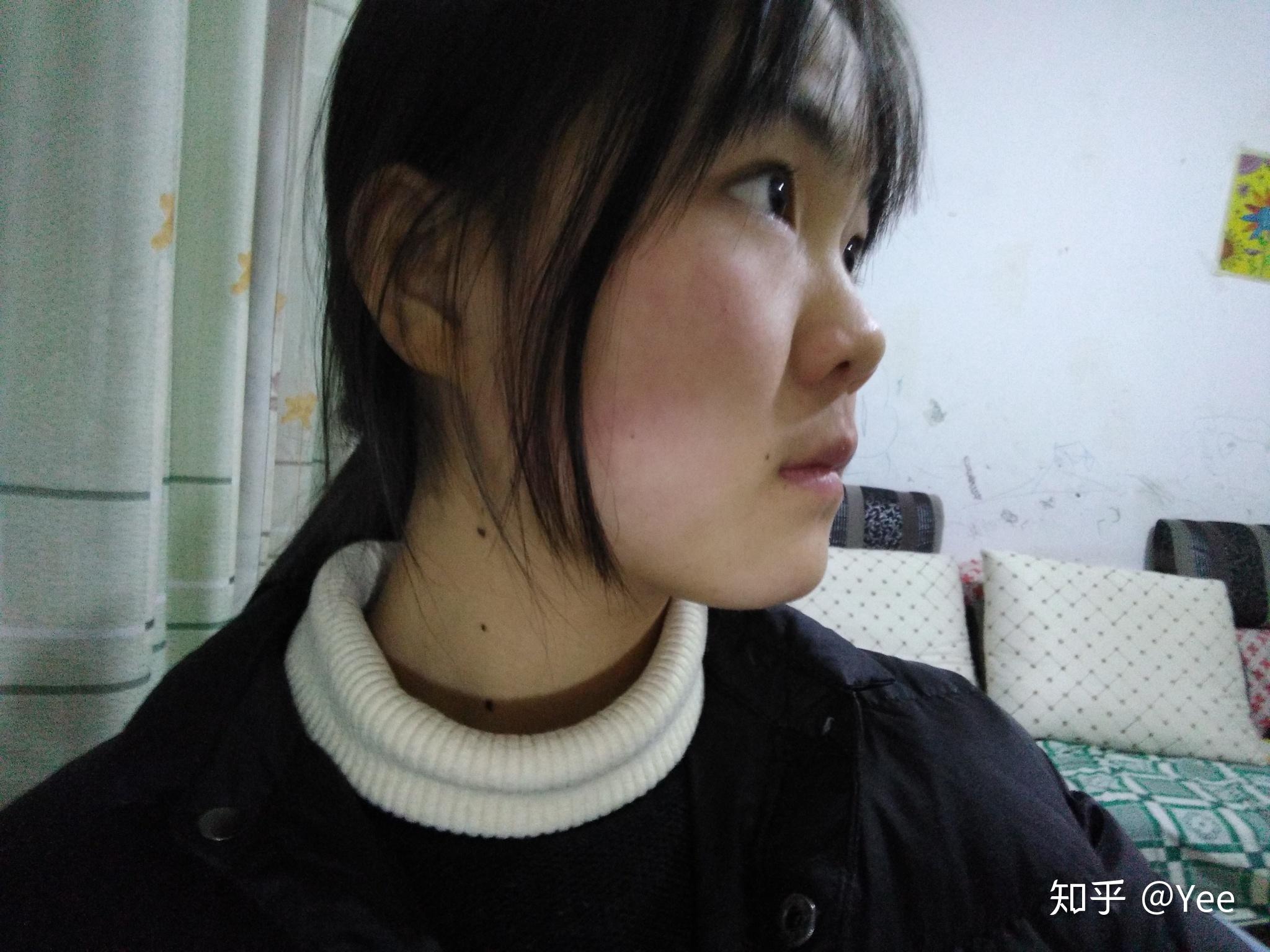 塌鼻子是一种什么样的体验?