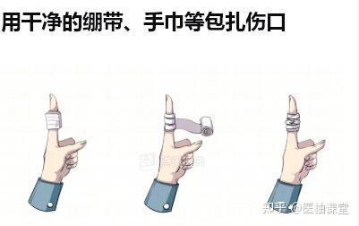 切割、离断伤的紧急处置 - 知乎