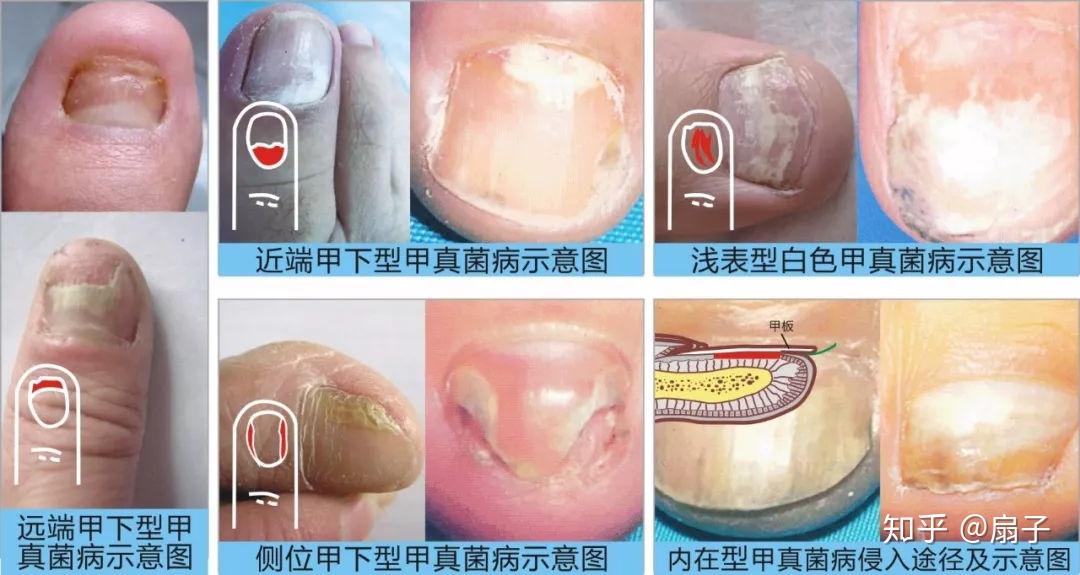 眼睛瘙痒与疼痛：常见原因及应对措施