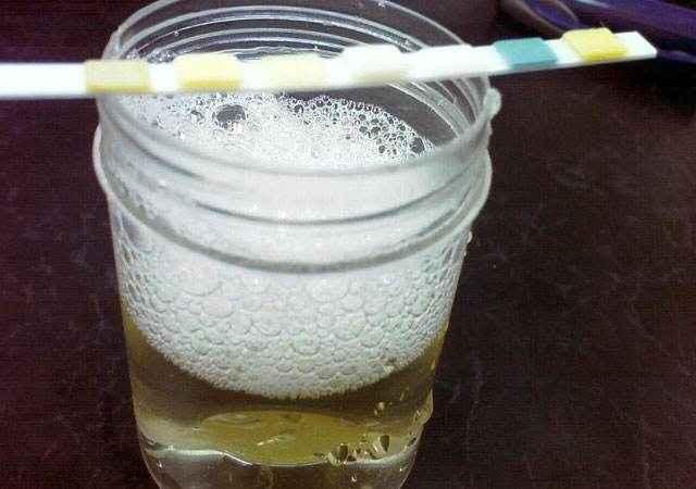 尿酸偏高常吃3种碱性水果尿酸会乖乖下降