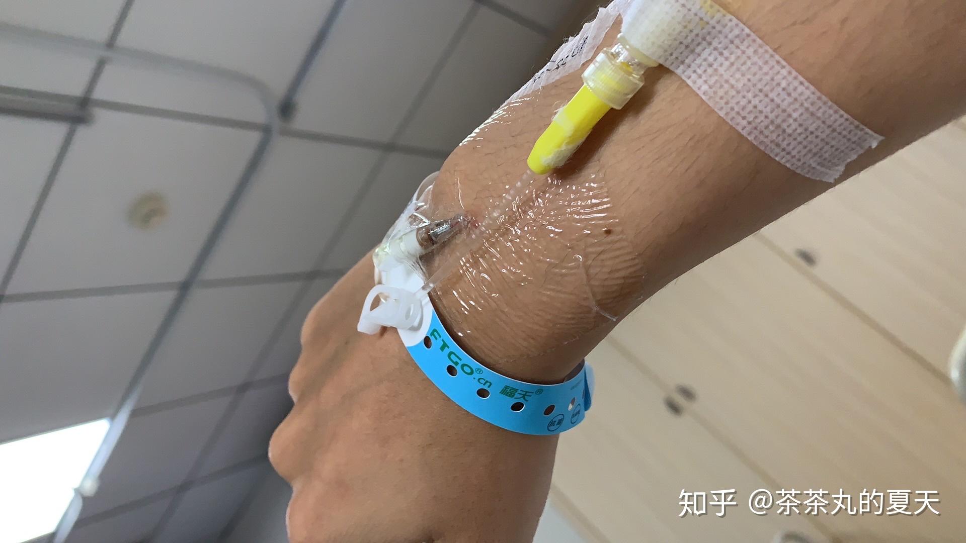 肛周脓肿变肛瘘躲不掉的一刀第三次发已康复