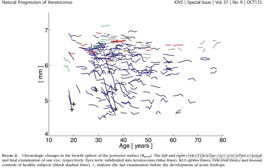 圆锥角膜的RGP验配及RGP临床效果分析（文字版） - 知乎