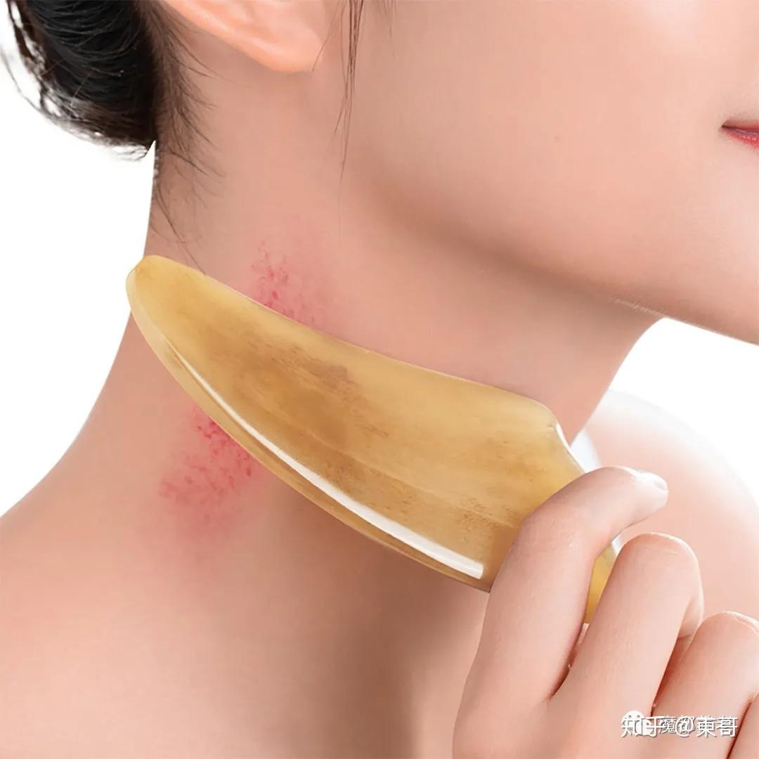 养生保健技能五来刮个痧吧