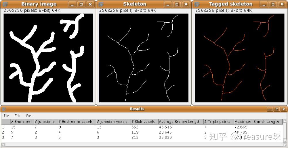 ImageJ实用教程——骨架化分析(定量分析篇) - 知乎