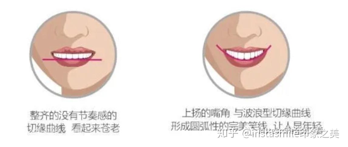 instasmile小课堂丨拥有年轻笑容的秘密 - 知乎