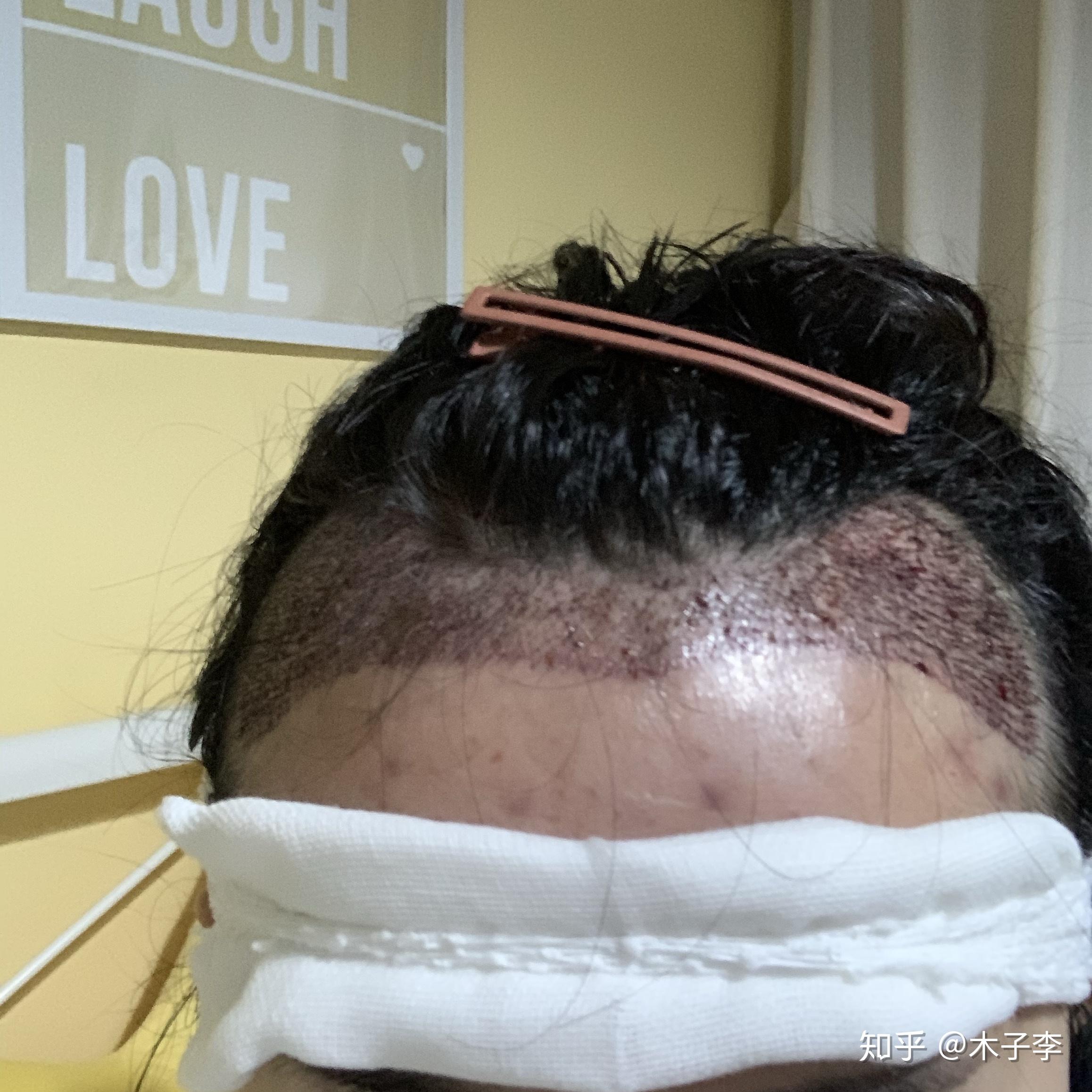 v2-bc8e03454fa7415be08e37b7ebc6afee_r.jpg