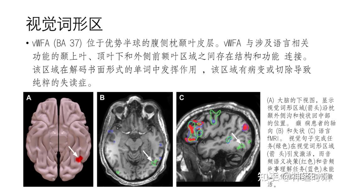 脑功能成像解剖 — 知识分享 - 知乎