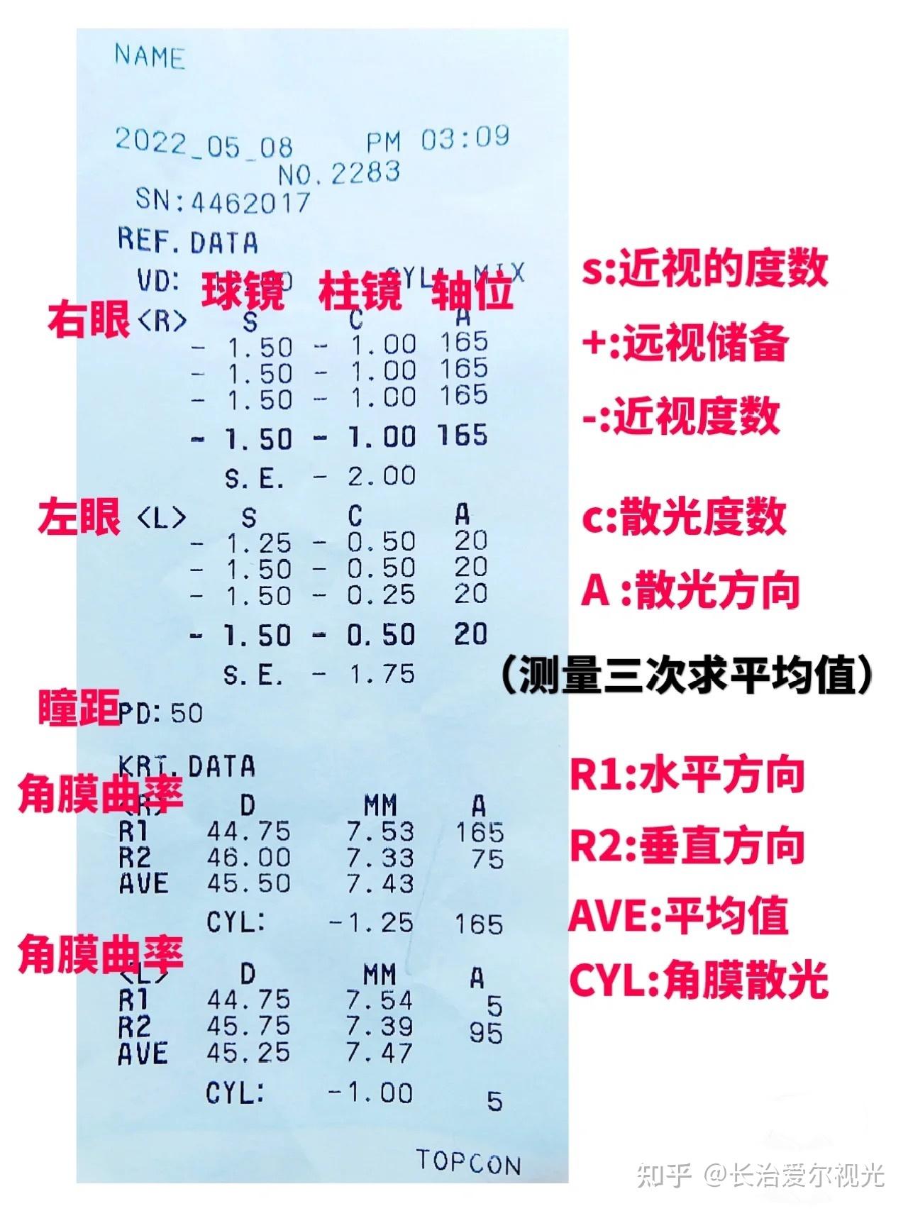 不會看電腦驗光單驗光這幾個數據最重要教你秒懂電腦驗光單