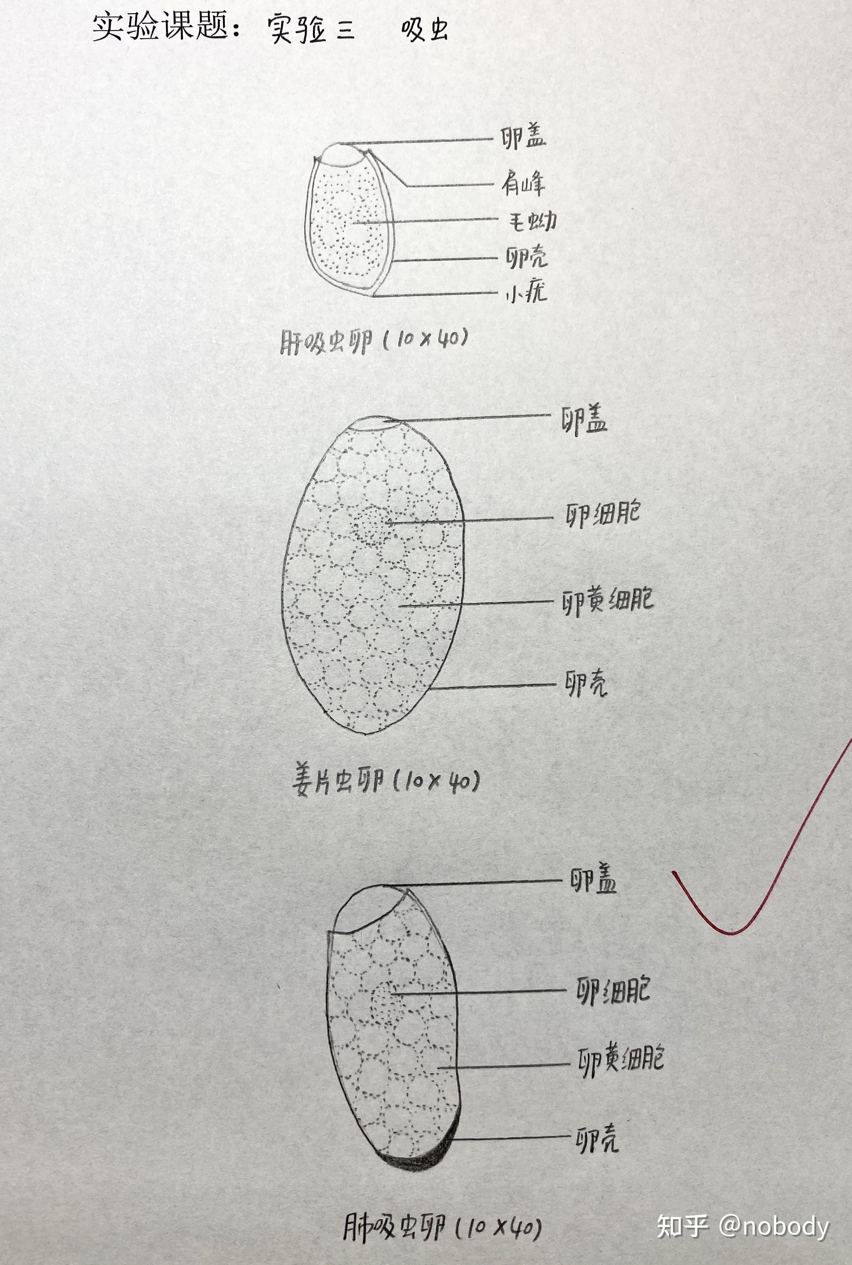 蛲虫卵3鞭虫卵2未受精蛔虫卵1受精蛔虫卵