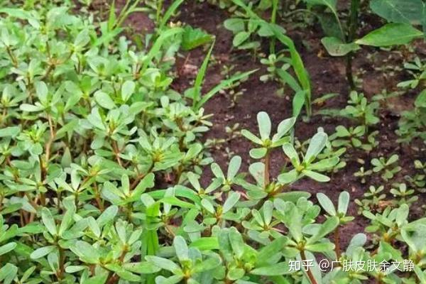 湿疹 荨麻疹 皮肤瘙痒过敏等皮肤病功效:清热解毒 祛风止痒马齿苋首都