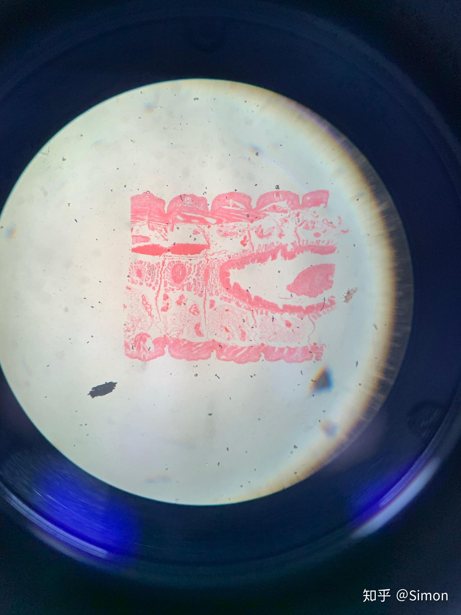 蚯蚓纵切这个是啥看不清蚯蚓贮精囊蚯蚓过咽头蚯蚓横切下面可能会引起