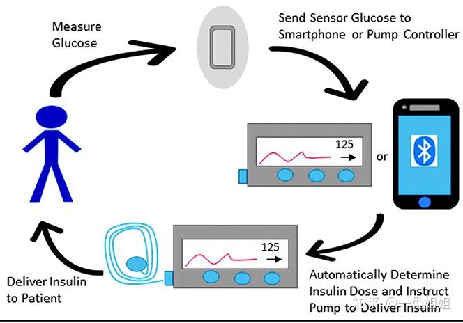 胰岛素泵 工作原理图片