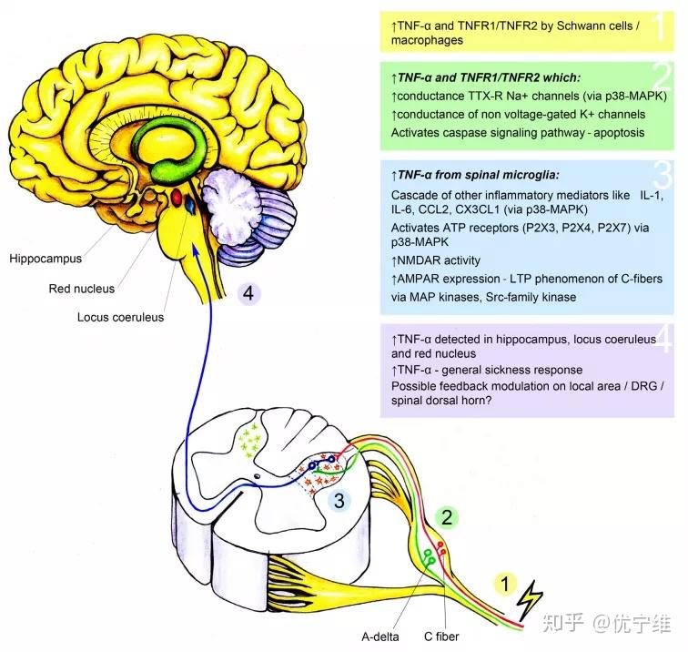 性疼痛中的作用:(1)在神经损伤部位;(2)在背根神经节;(3)在脊髓背角