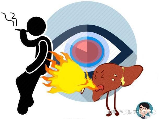 为什么春季要养肝