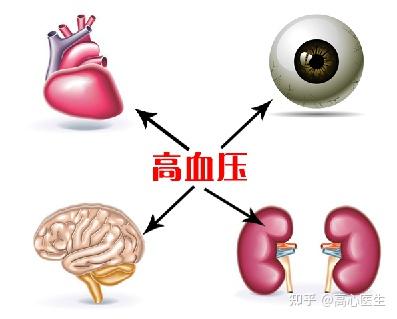 v2-bd9ac8fc271494f3e9264eacc80d06ce_b.jpg
