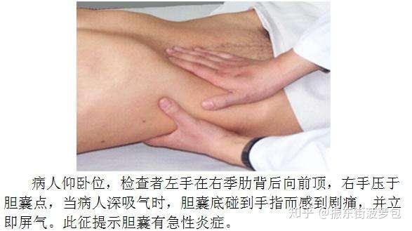 阑尾炎是哪边疼图片 v2-bdc2123452b6f378114d8417ac10ec2a_r.jpg