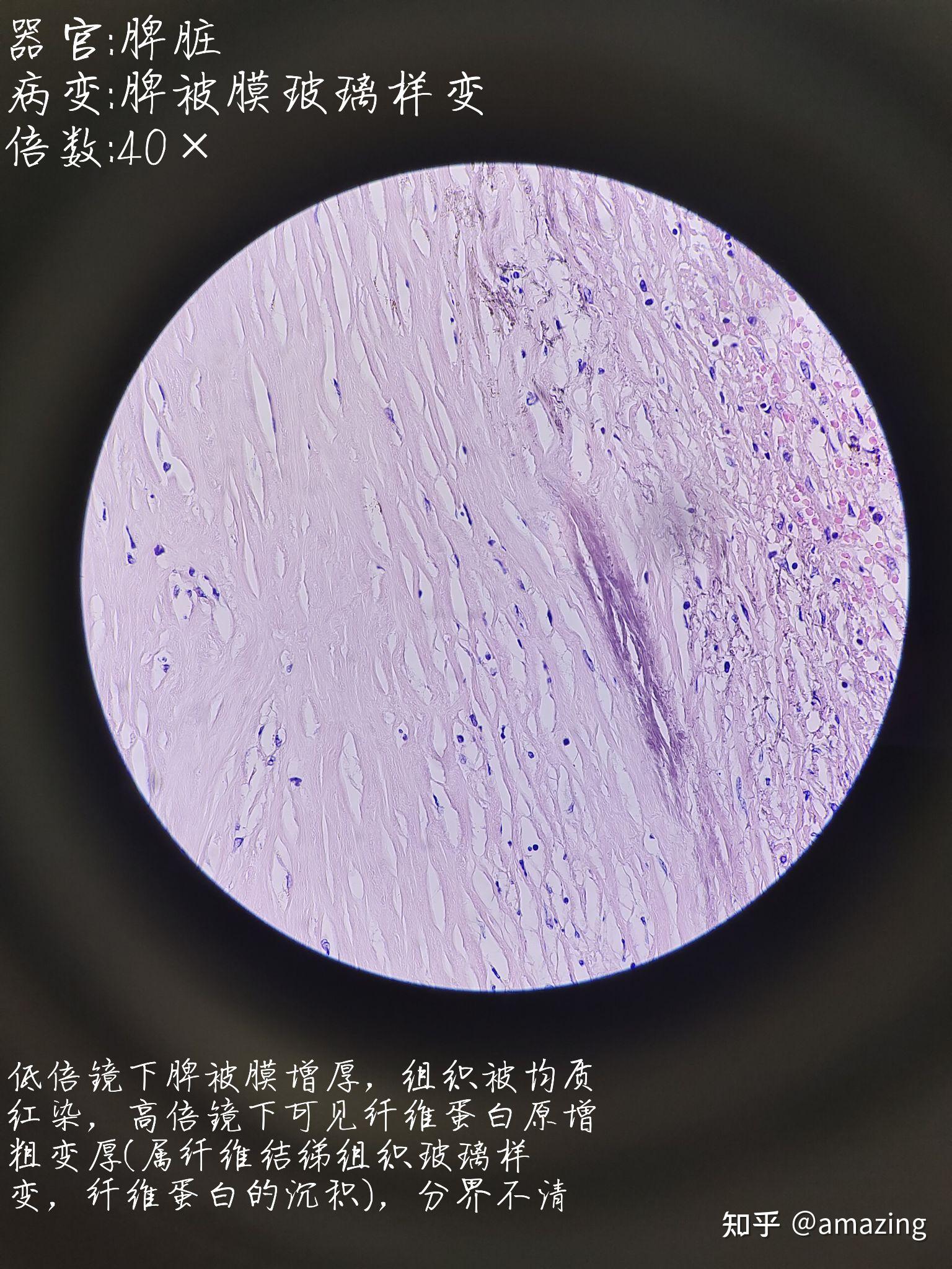 病理学病理切片实验心得一细胞的适应