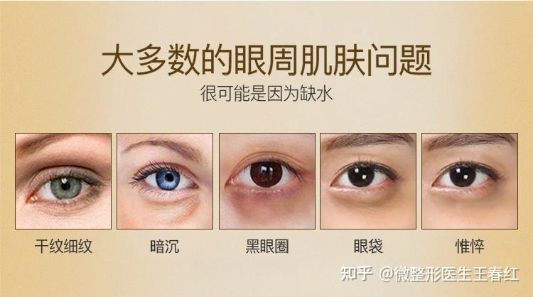 内轮廓眼周问题,有什么轻医美方案? - 知乎