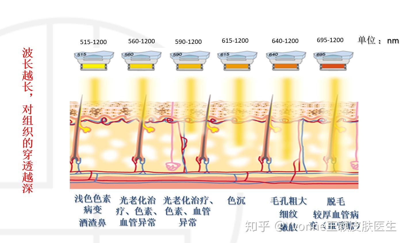 m22光子嫩肤的滤光片使用有什么不同