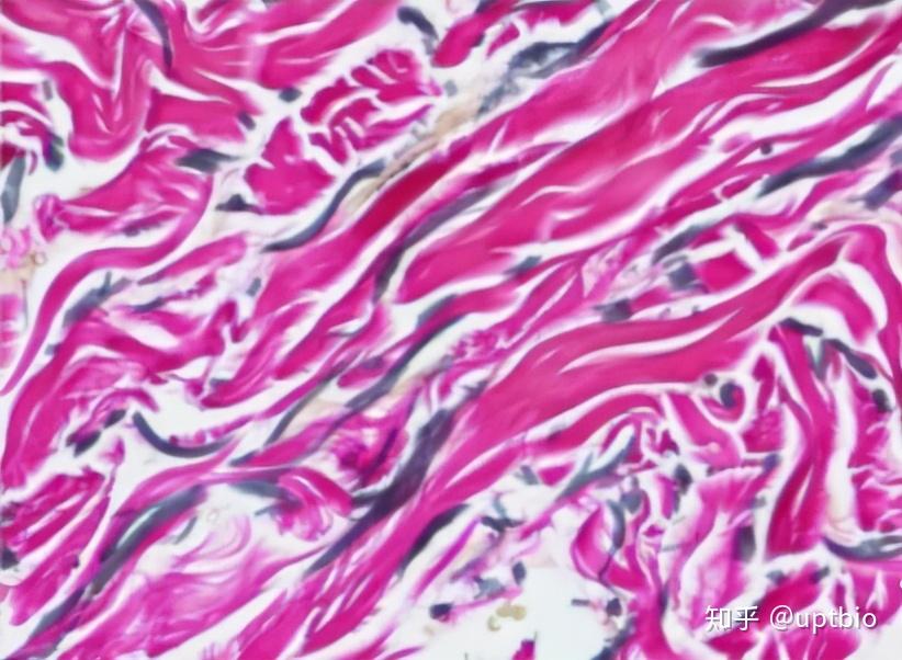 masson染色(马松三色)用途:用于胶原纤维和肌纤维的鉴别染色.