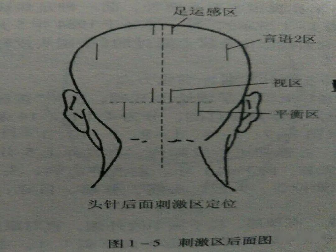 针灸微针