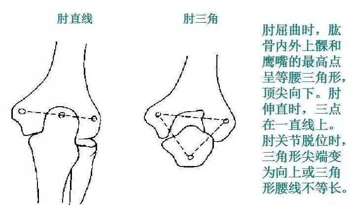 5.肘三角与肘直线4.肘关节外部形状检查3
