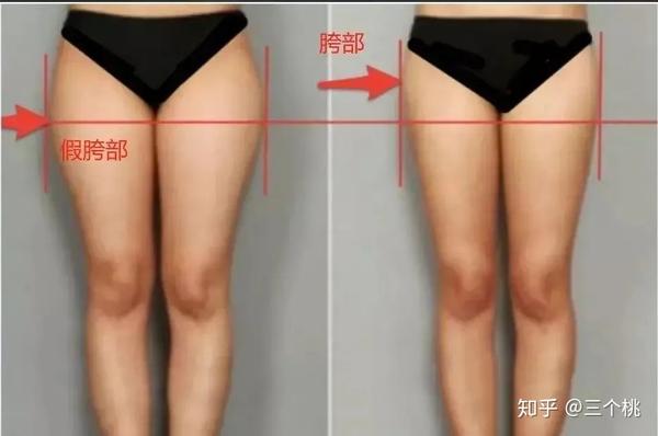 假胯宽 大腿粗的困扰 我花了4个月来改善 真的有用 知乎