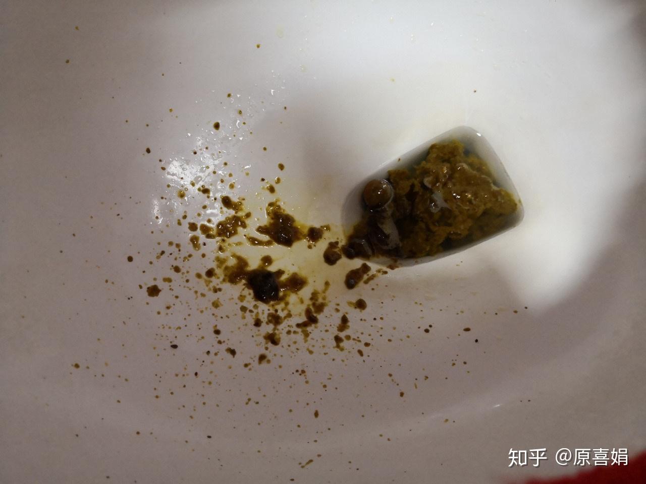 【与身体对话】我的七天辟谷计划第二天