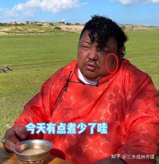 真不要命了？网红恩克近况不佳，脸上黑斑扩散，网友：钱比命重要？ - 知乎