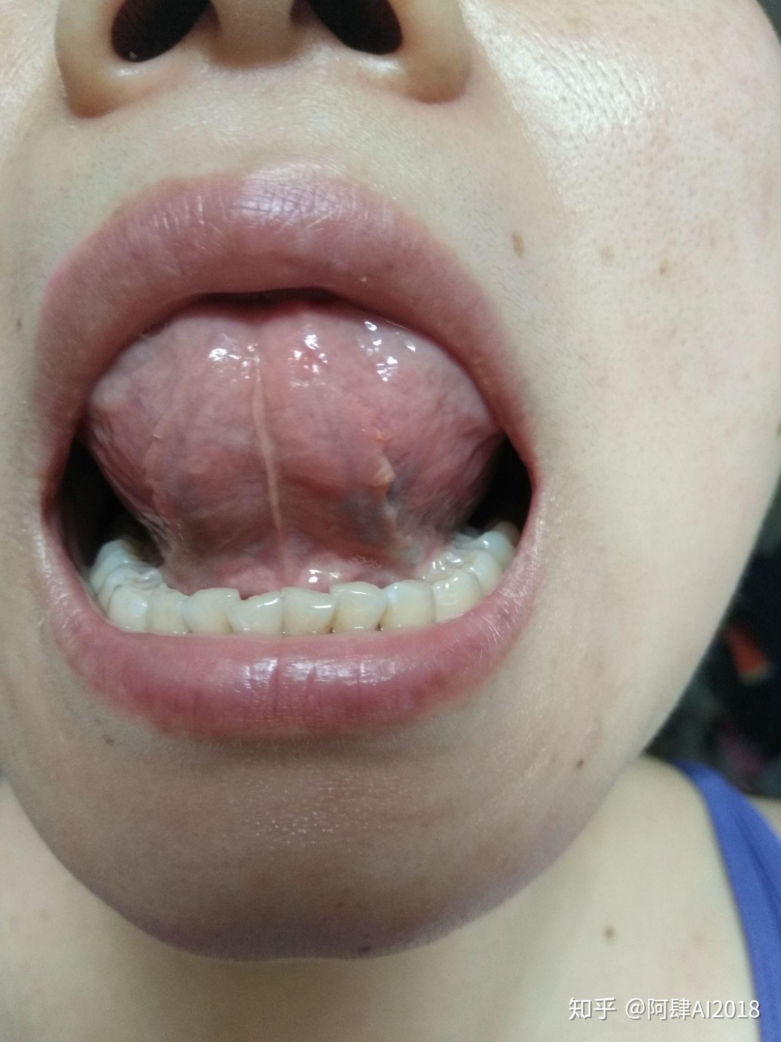 照镜子,发现眼皮发红肿,不痒.这是怎么了?6.22.入夏以来手脚心发热.