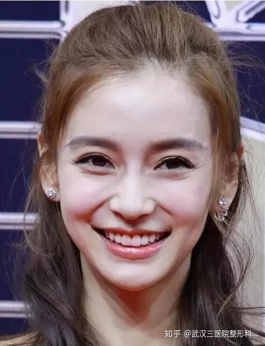 轮匝肌的收紧,下眼睑上移,卧蚕隆起,眼尾自然往下弯,笑意挂在眼梢,正