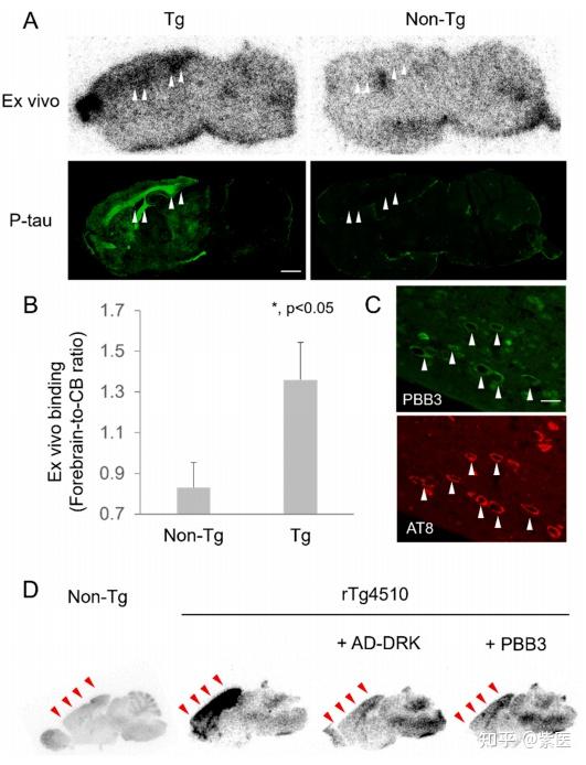 PET/CT 太贵？要不试试 SPECT/CT，还是Aβ与Tau双靶点探针！ - 知乎