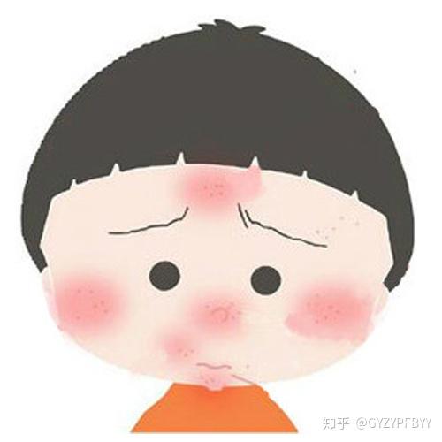 脸过敏发红痒去贵阳那个皮肤病医院