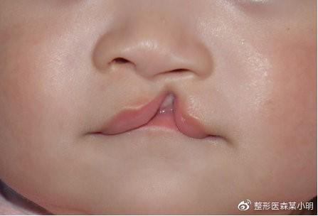 v2-bf973044cc03870aea0ebca2fffa78ca_1440w.jpg?source=172ae18b